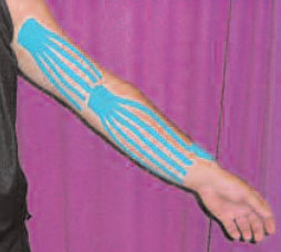 Kinesiotape1.jpg