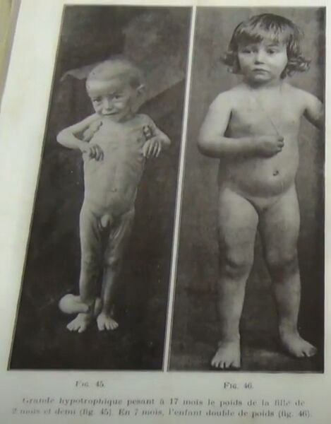 Datei:Wunderheilung Meerwasser.jpg