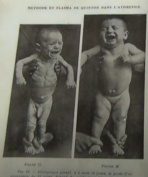 Datei:Meerwasser Wunderheilung Rene Quinton.jpg